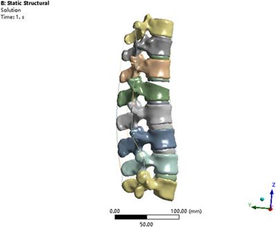 Biomechanical evaluation of different posterior fixation techniques for treating thoracolumbar burst fractures of osteoporosis old patients: a finite element analysis